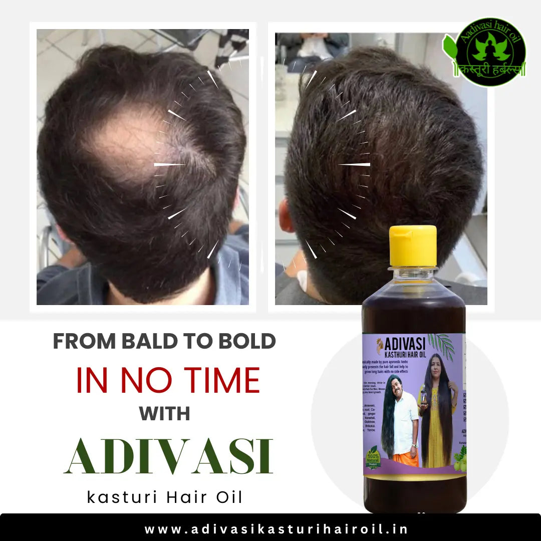 Adivasi Kasturi Hair Oil (4.9 ⭐⭐⭐⭐⭐ 18,473 REVIEWS) Globally